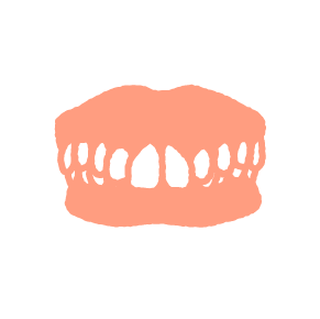 深い噛み合わせ